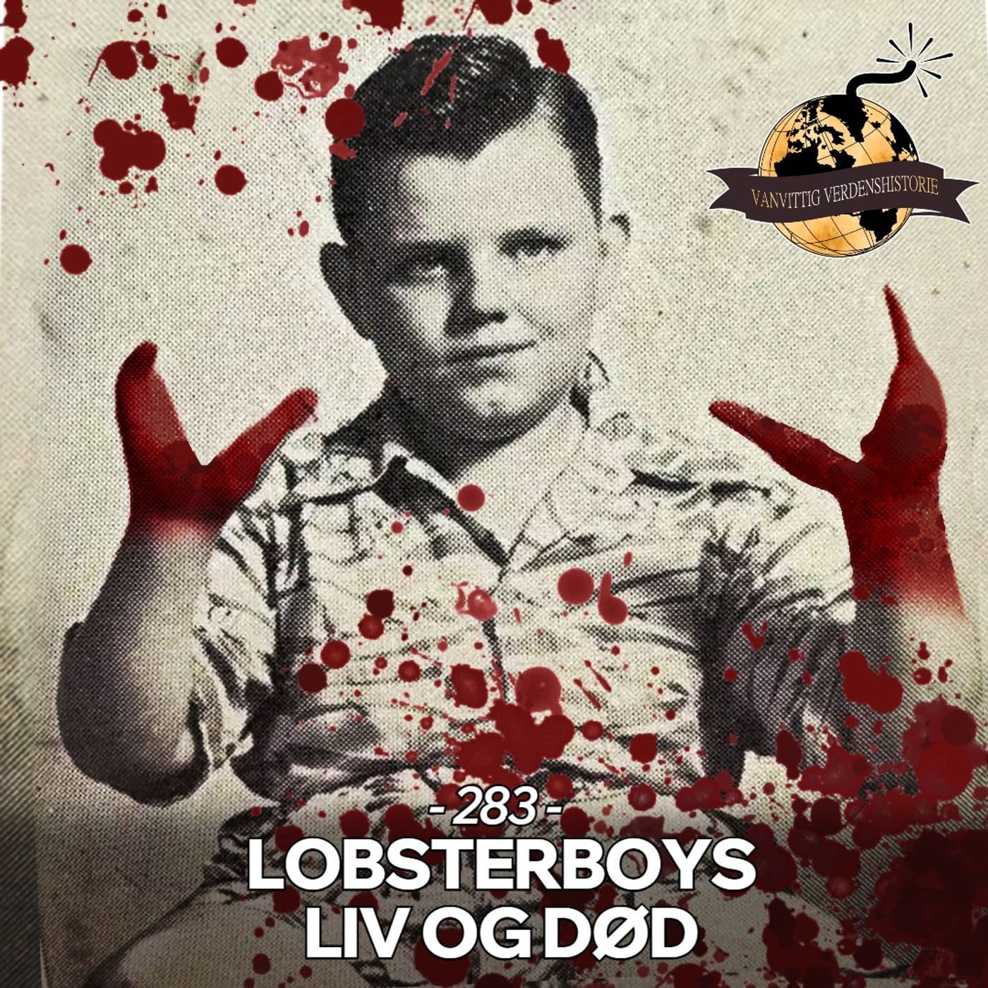 #283: Lobsterboys Liv og Død artwork