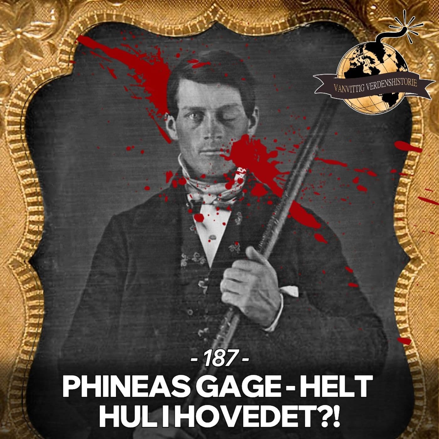 #187: Phineas Gage: Helt Hul i Hovedet!? artwork