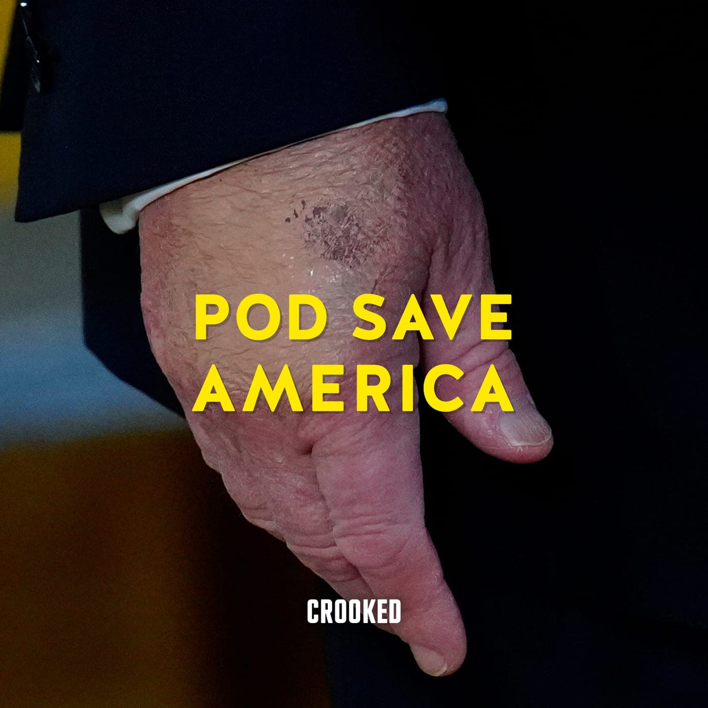 The Bruised Hand in the Cookie Jar artwork
