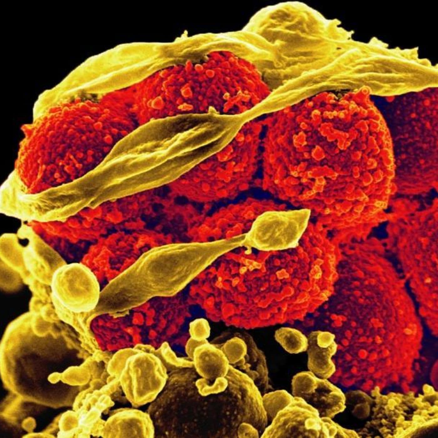 Antibodies Part 1: CRISPR artwork