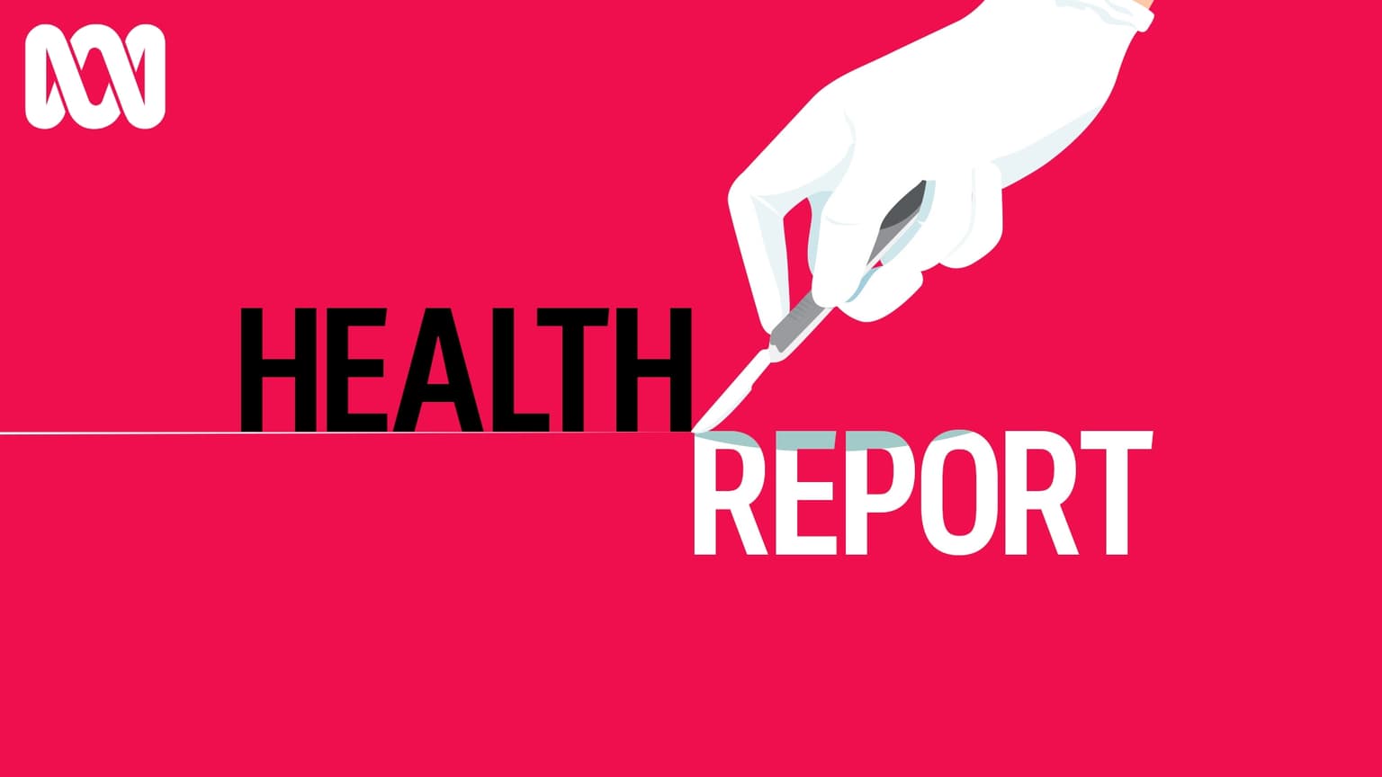 Rise in injecting drug use | Schizophrenia and sudden death | Change needed in bypass surgery | Breakthrough in cause of fatigue artwork