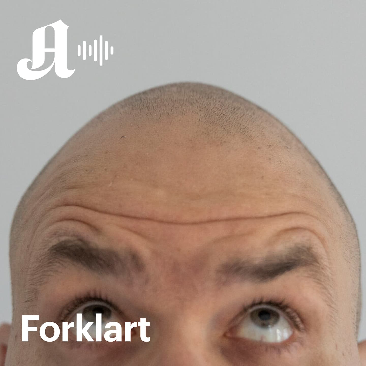 Kjøpe hår eller være skalla? artwork