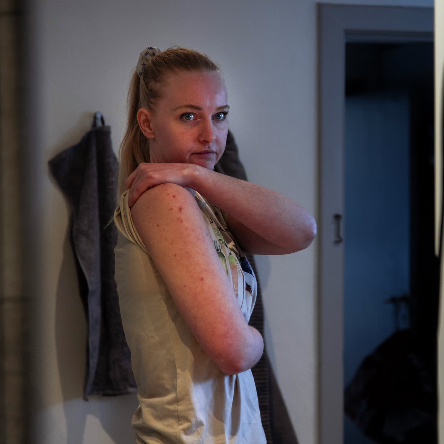 Udvalgt: Smidstrup-mysteriet – naboer til grønt anlæg får næseblod og blister i munden artwork