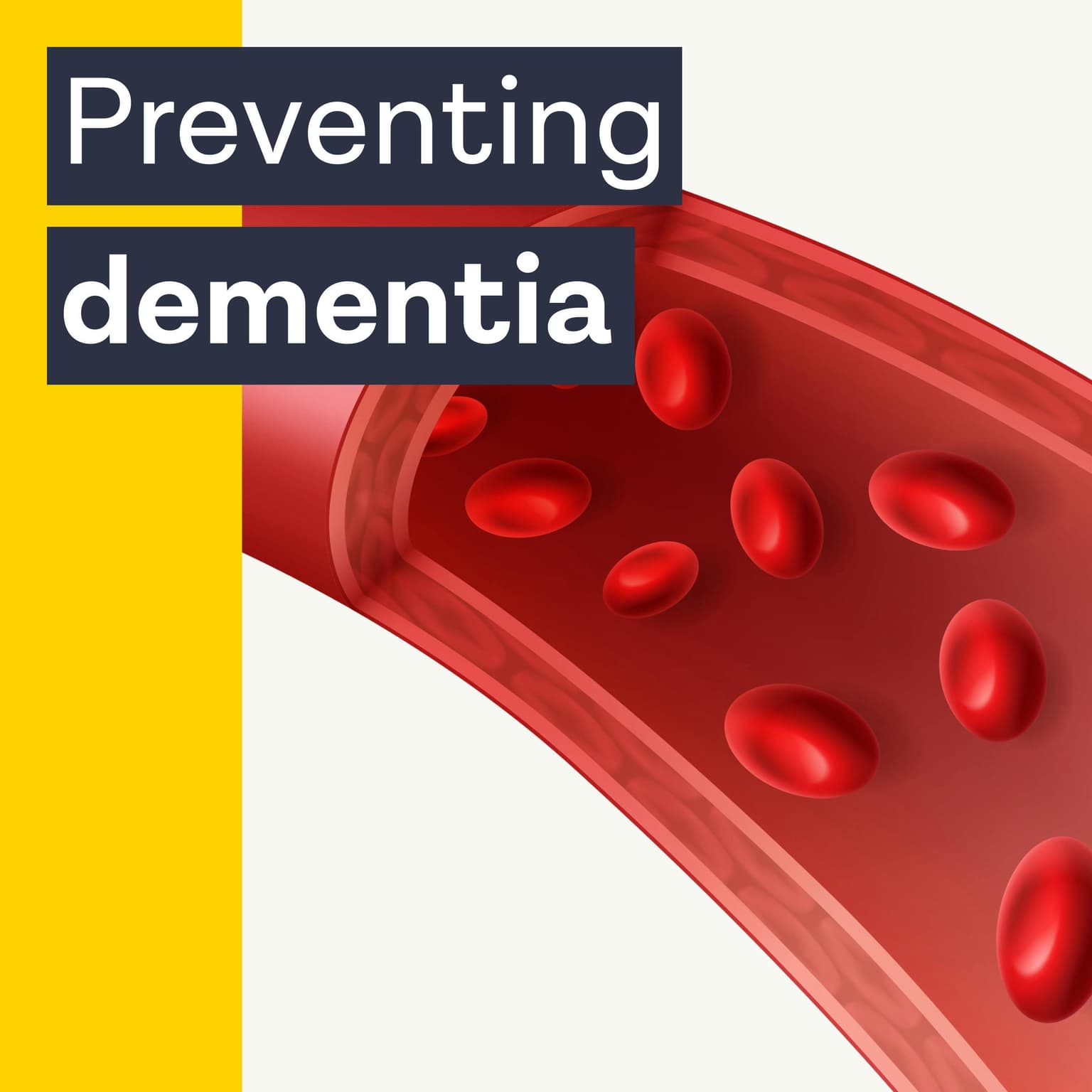 Why dementia could start in your blood vessels with Dr. William Li artwork
