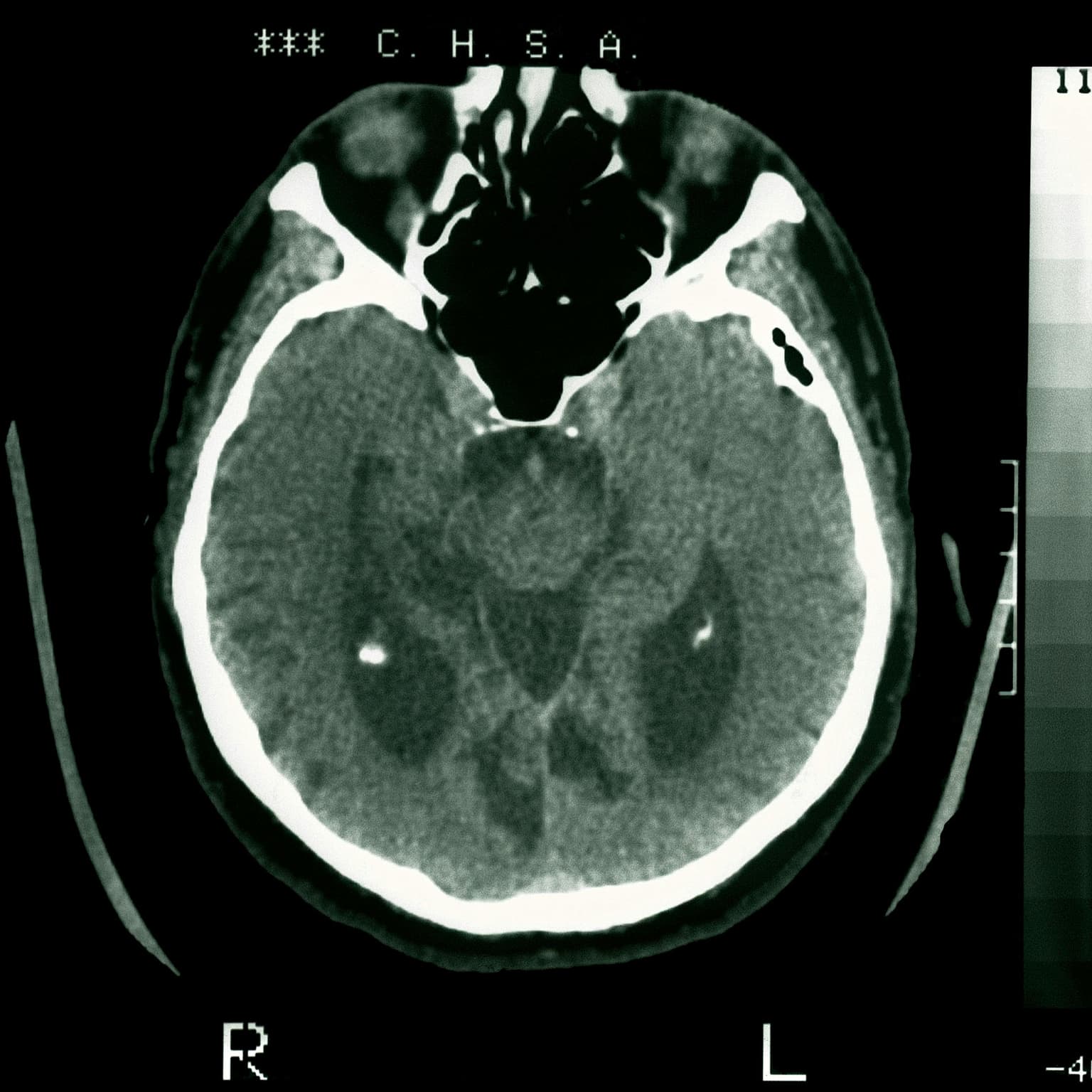 Battling brain rot artwork