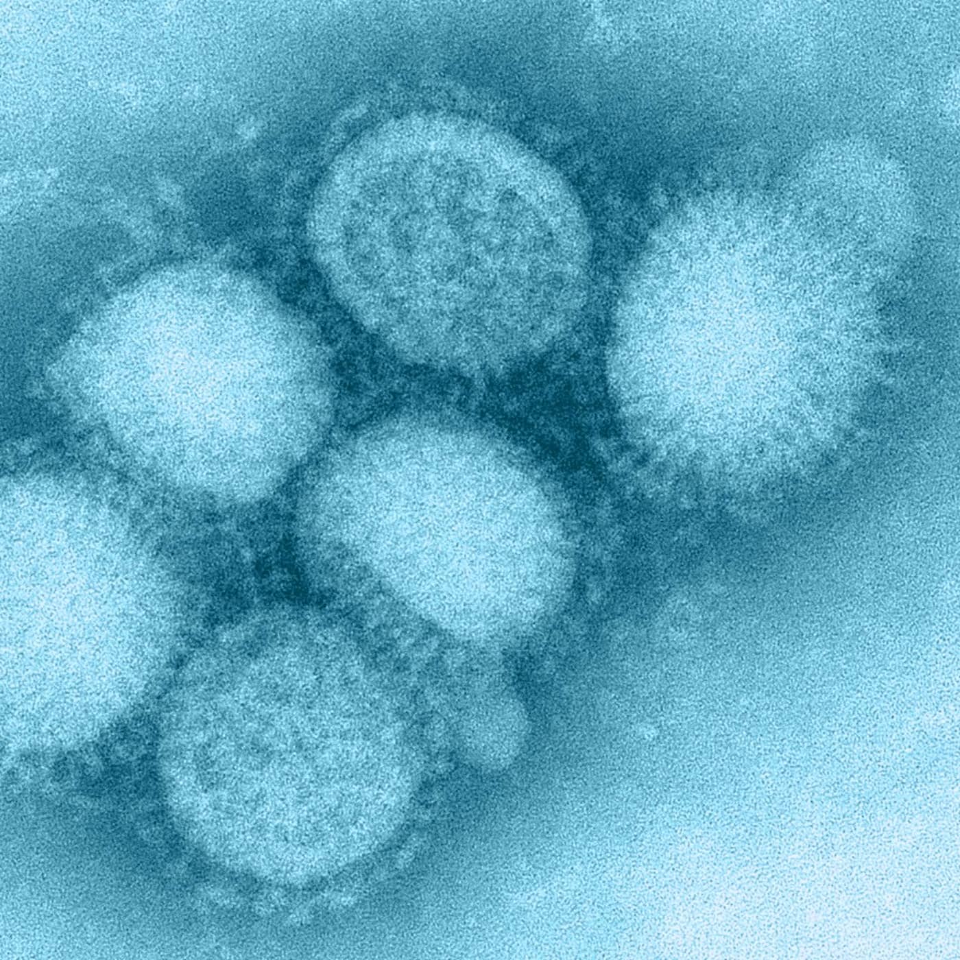 Pandemin - svininfluensan och konsten att vaccinera en hel befolkning (R) artwork