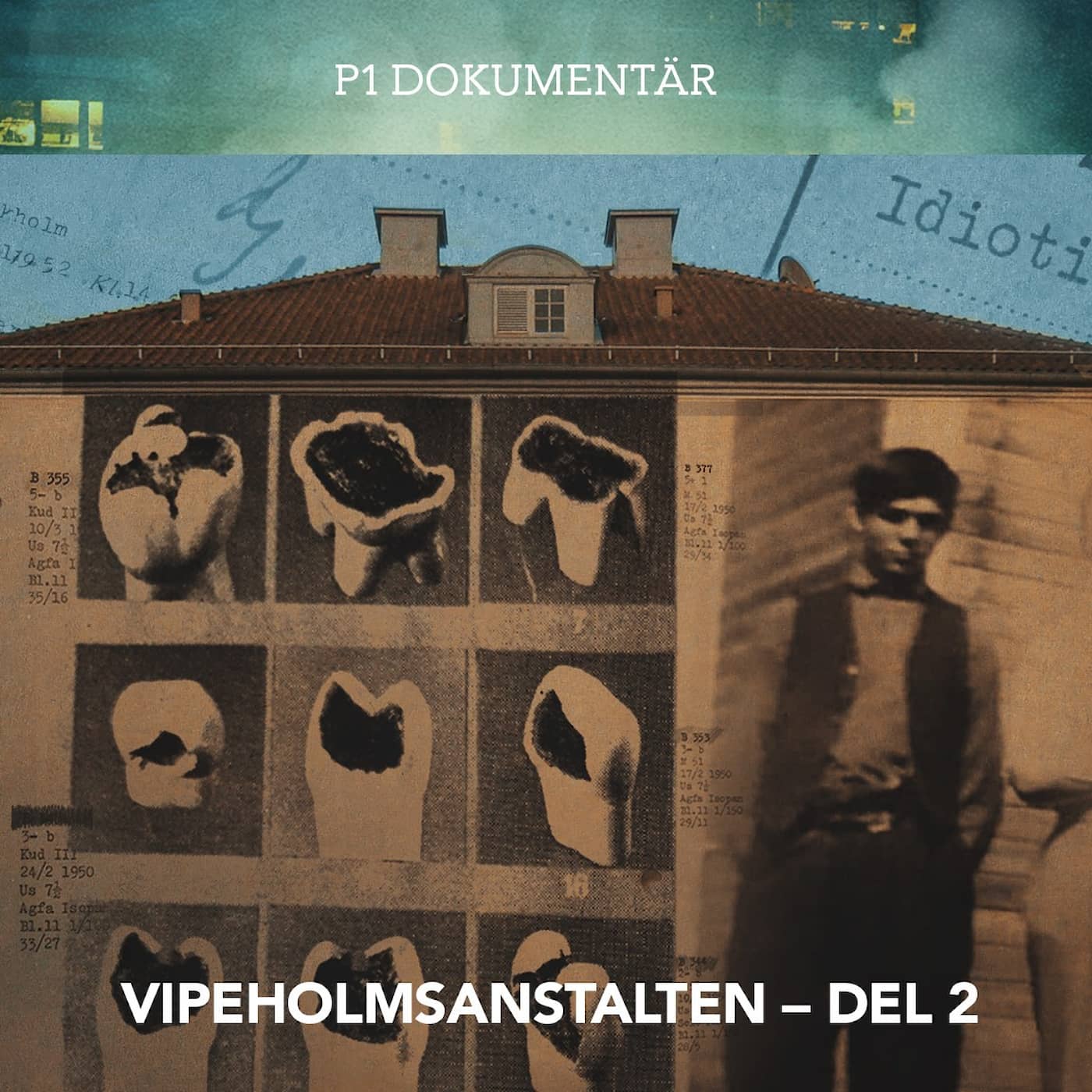 Vipeholmsanstalten – Kariesexperimentet och barnen | del 2 artwork