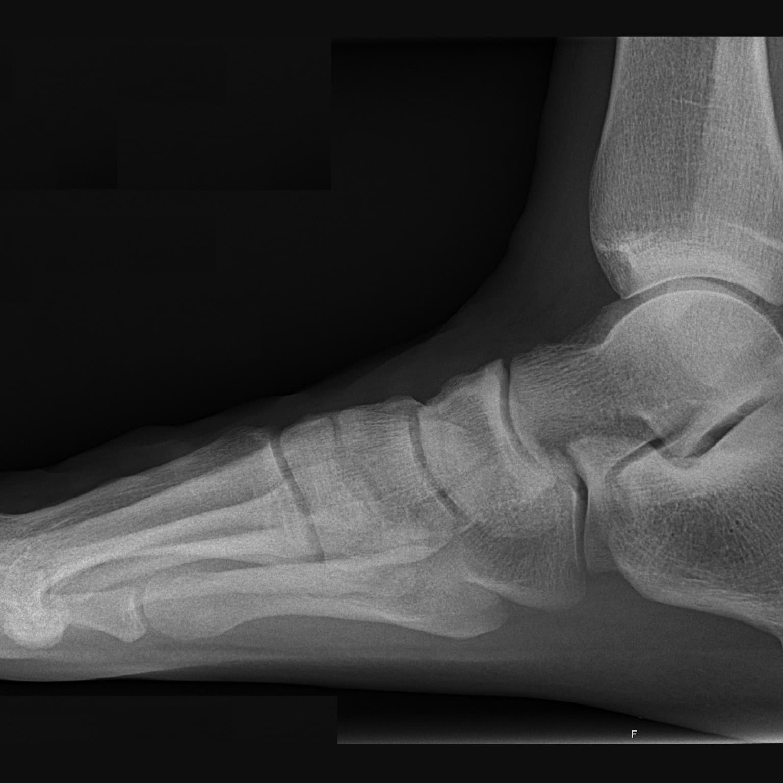 Feet of Engineering with Michael DiTullo and Jason Hanft artwork