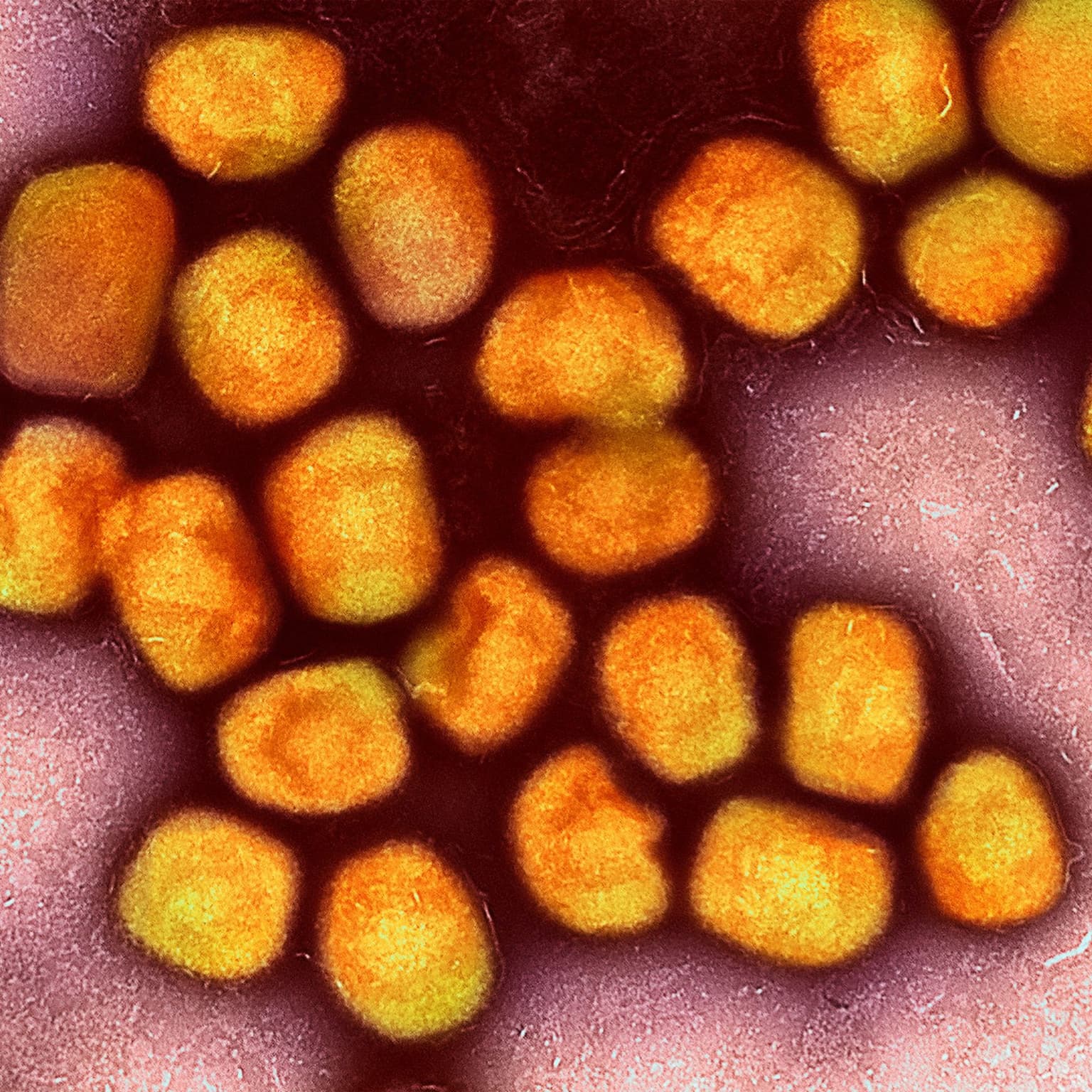 What is Monkeypox? With Dr. Anne Rimoin artwork