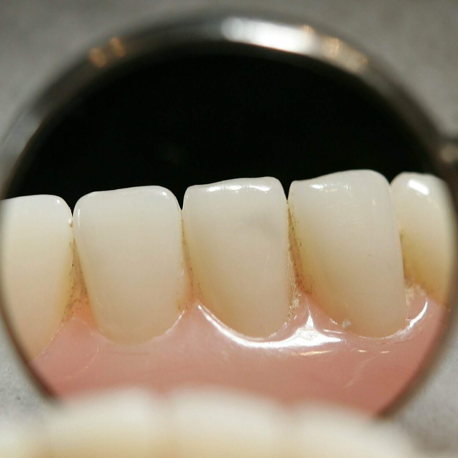 The value of good teeth artwork