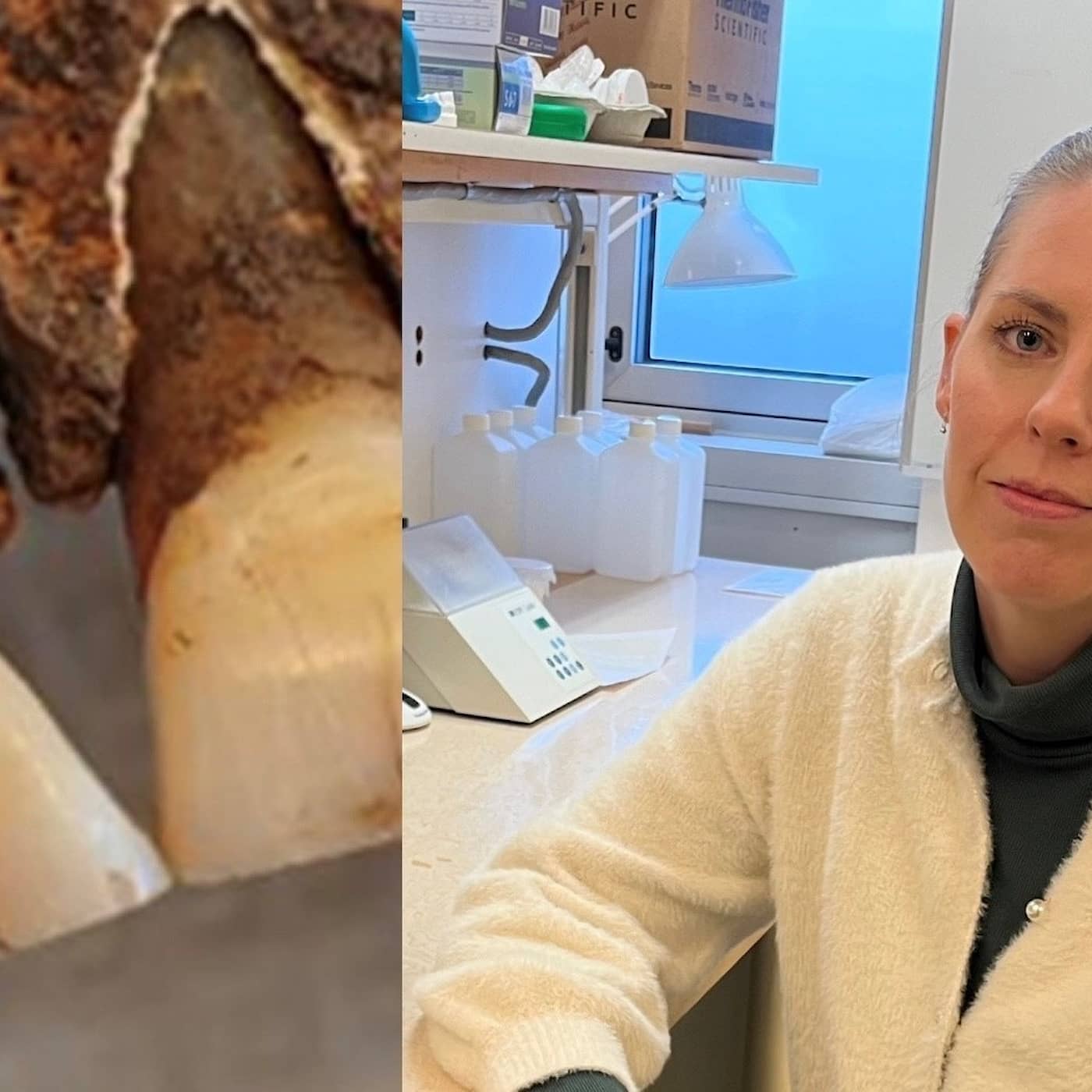 Carolina är tandläkaren som undersöker vikingatida tandvärk artwork