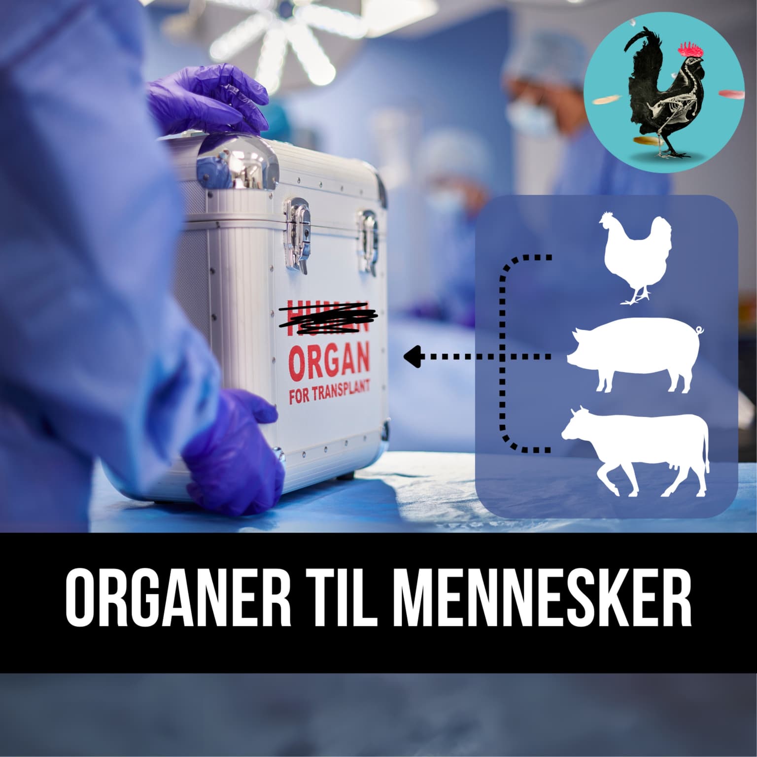 #213: Kan organer fra dyr bruges i mennesker? artwork