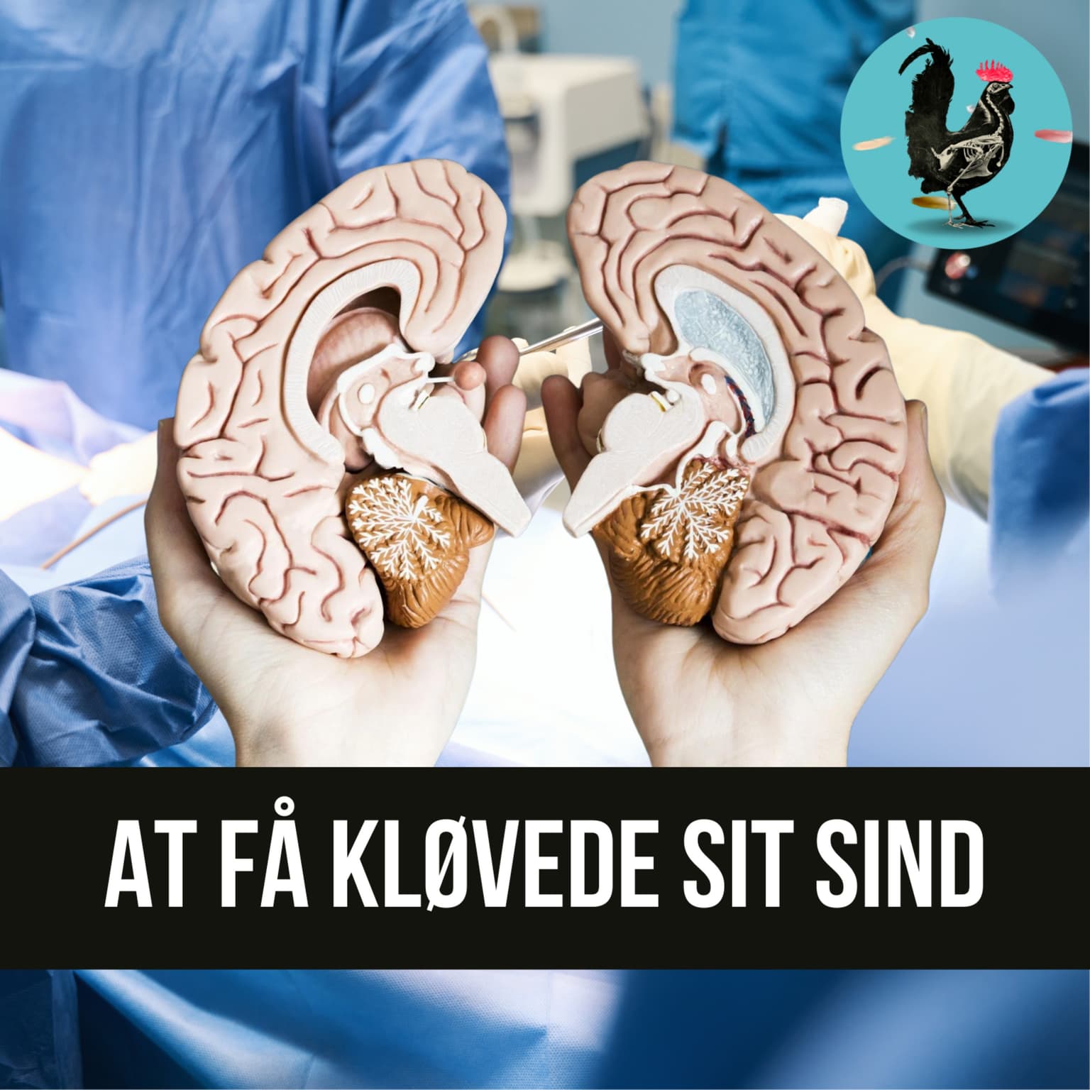 #189: Få flækket hjernen! (Live) artwork