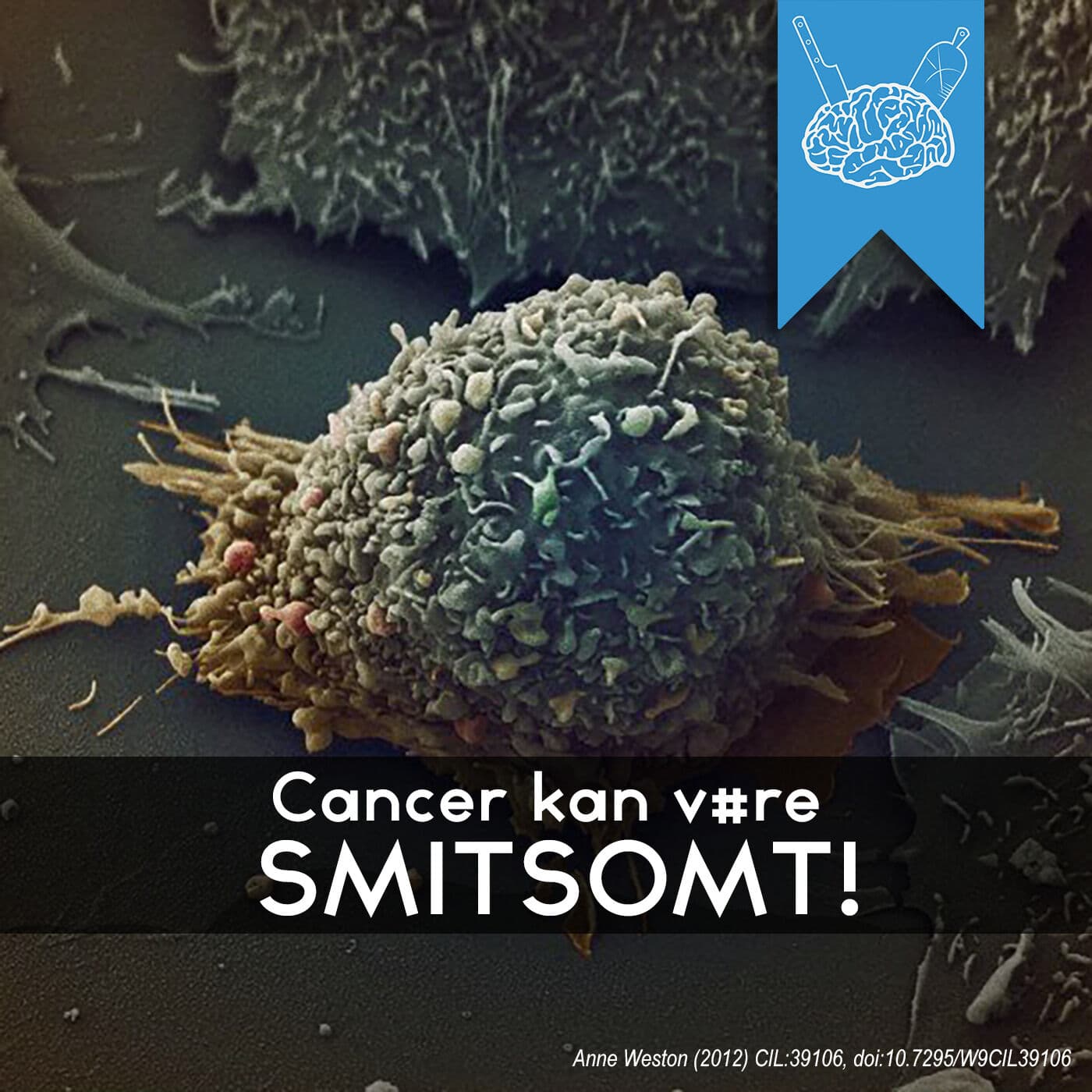 #3.58: Cancer kan være smitsomt! artwork