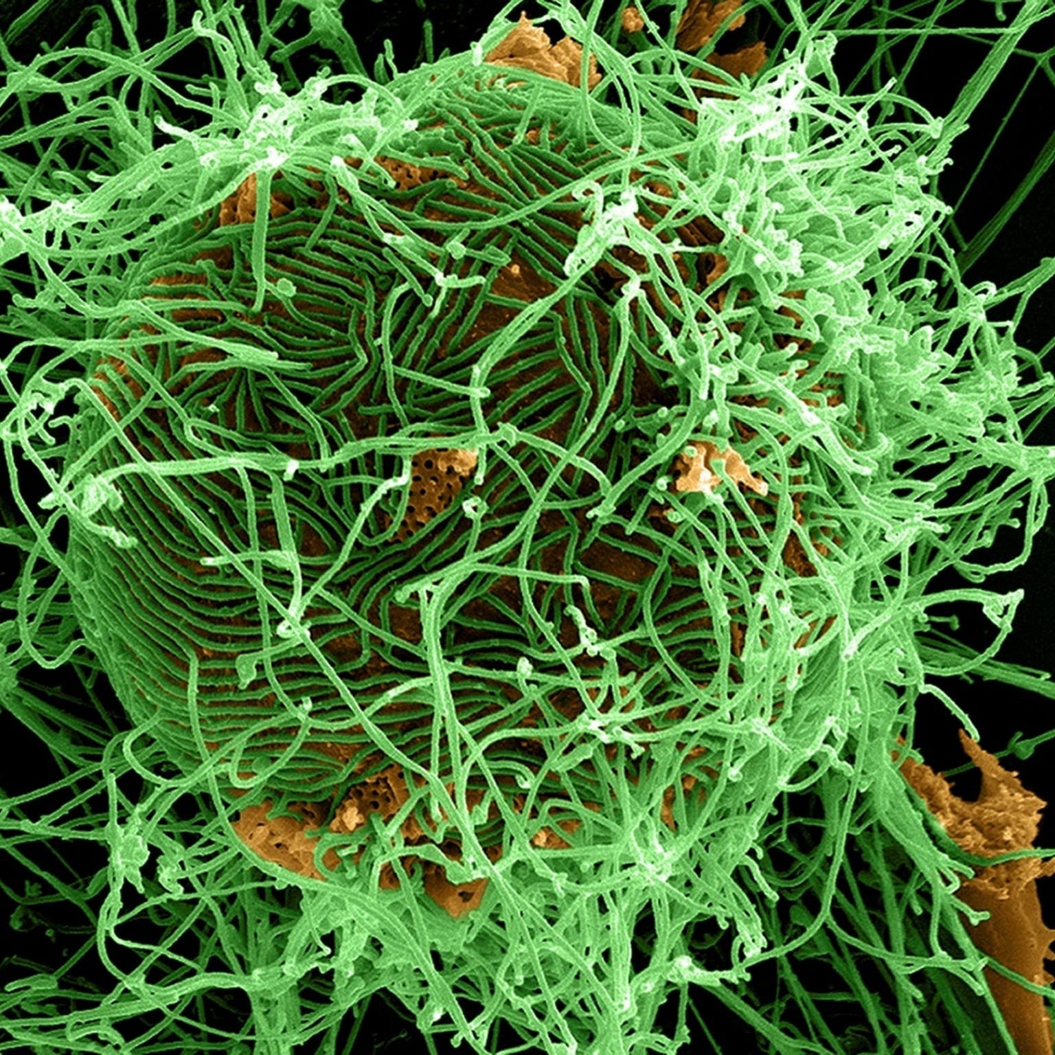 What we know about latest Ebola outbreak artwork
