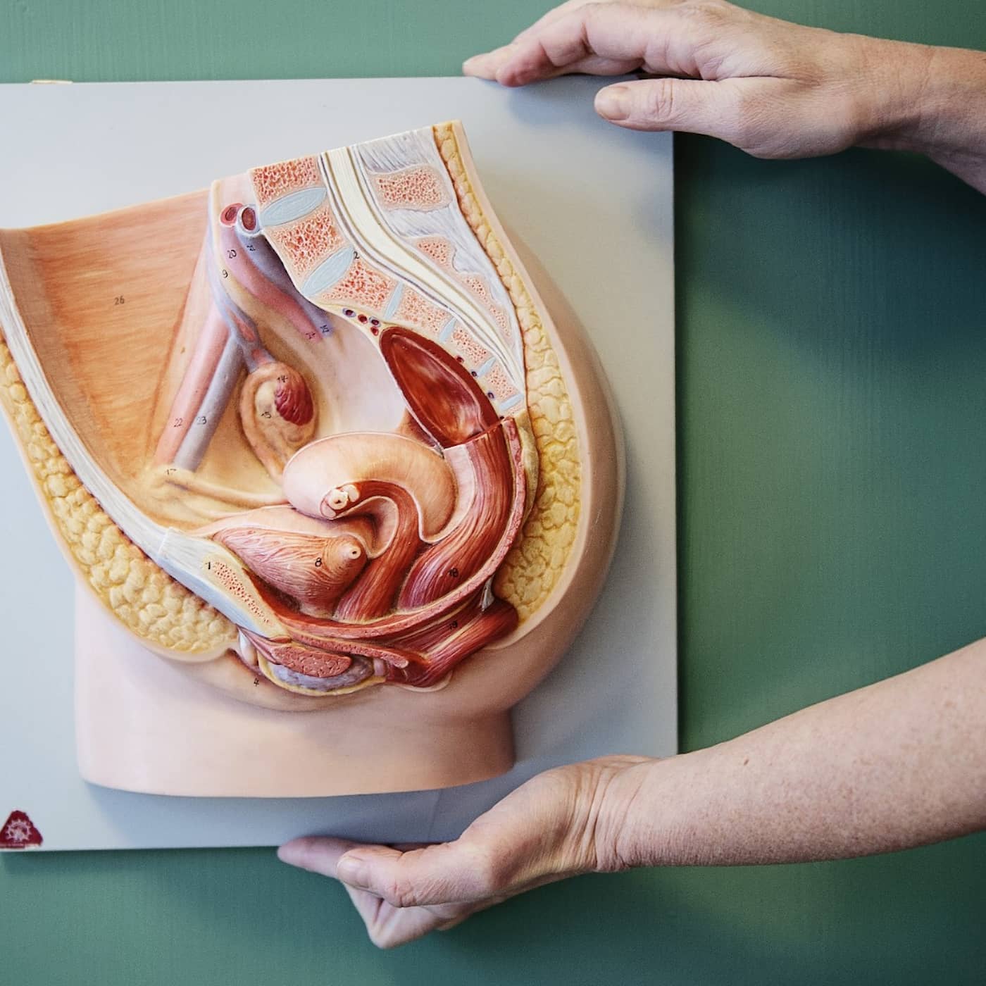 PCOS – vanligare än man tror artwork