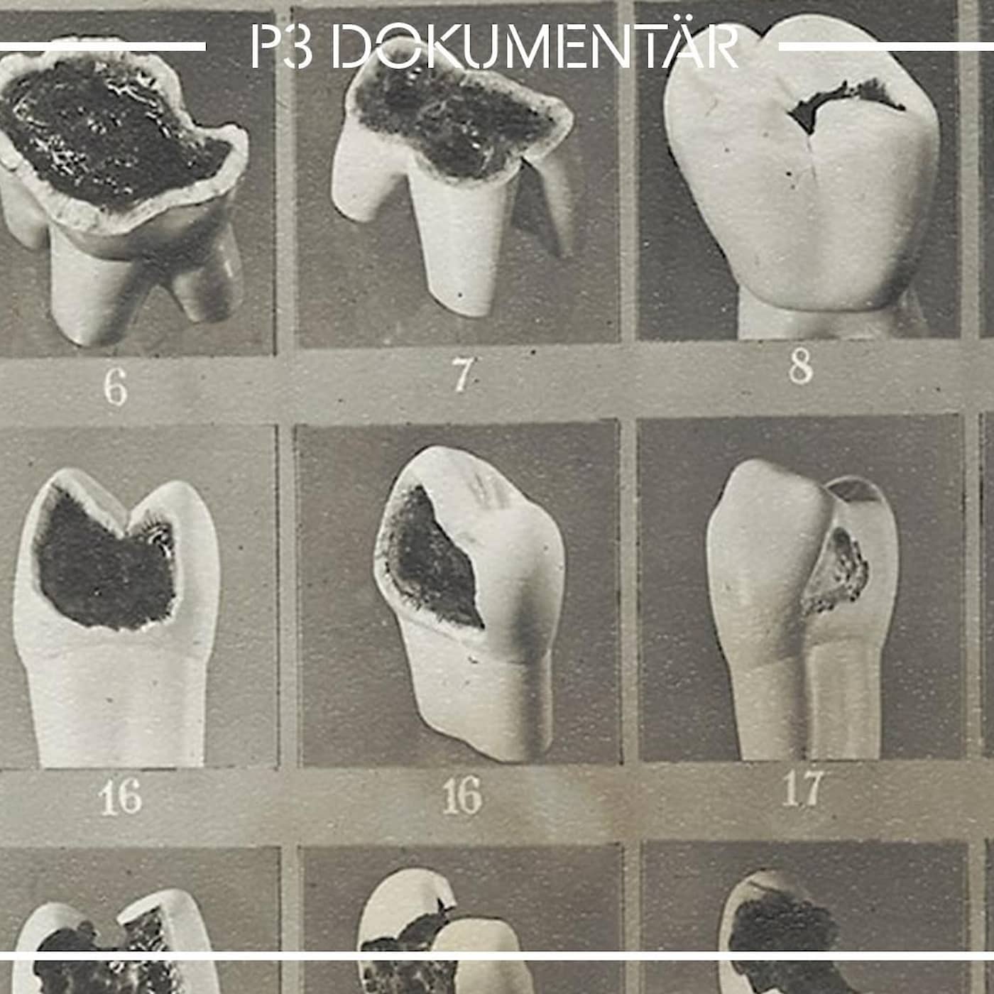 Vipeholmsexperimenten artwork