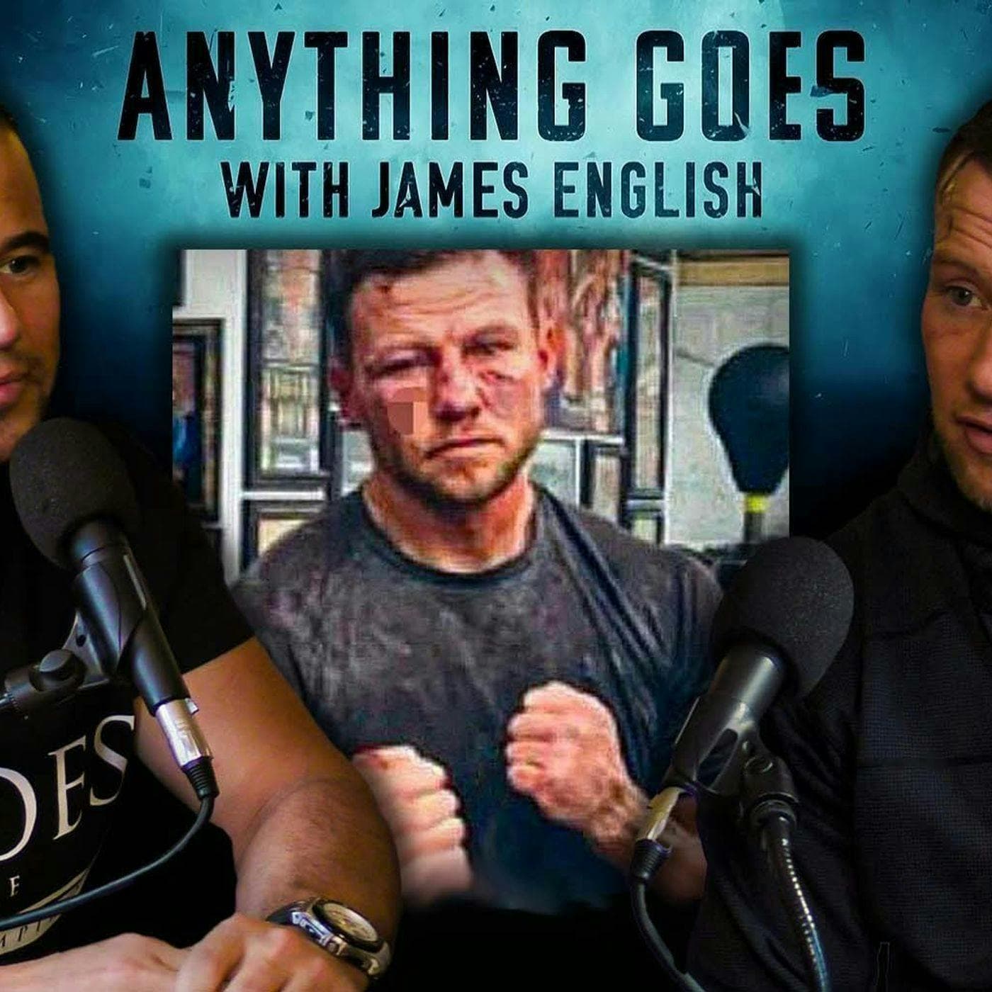 Bare-Knuckle Fighter Danny Christie Tells His Story artwork