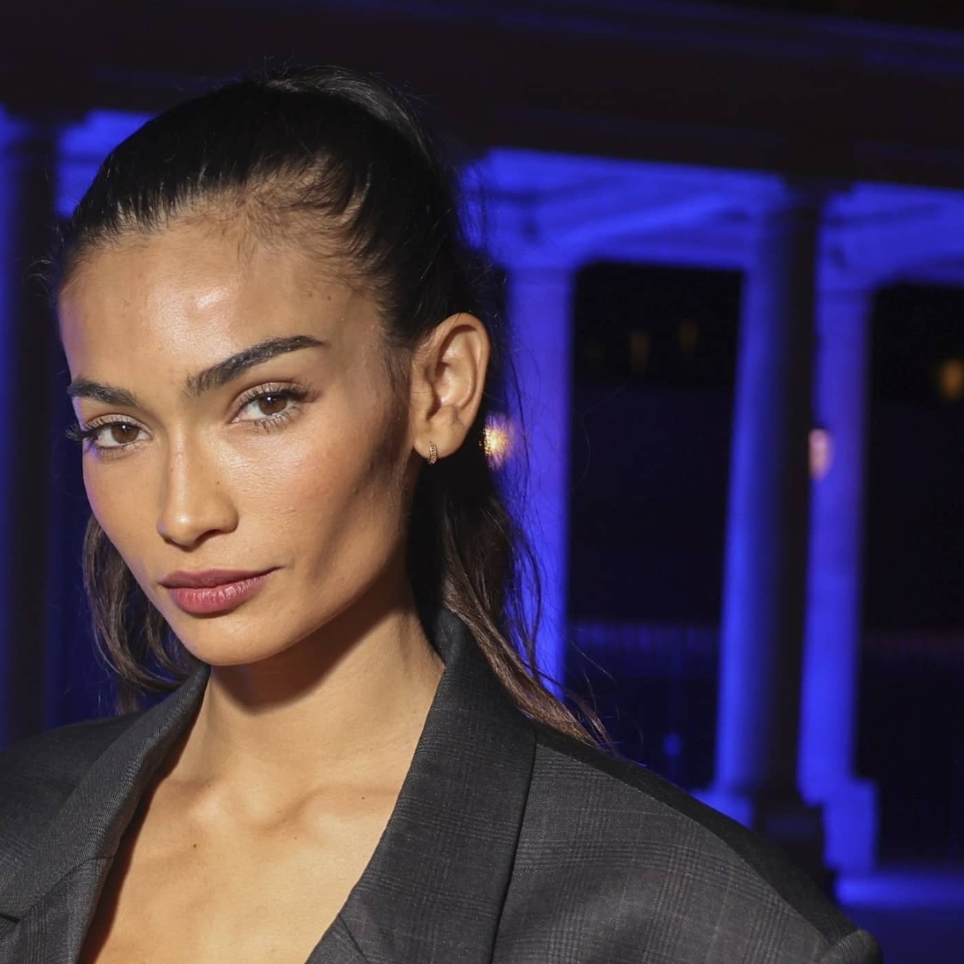 Supermodellen Kelly Gale: Jag var mobbad för mitt utseende artwork