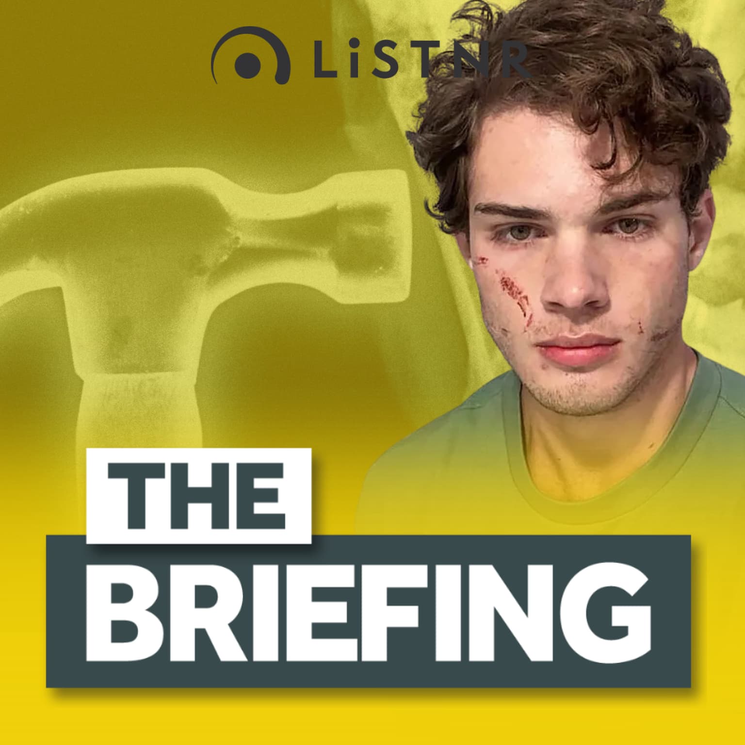BONUS: The looksmaxxing trend putting young men in hospital artwork