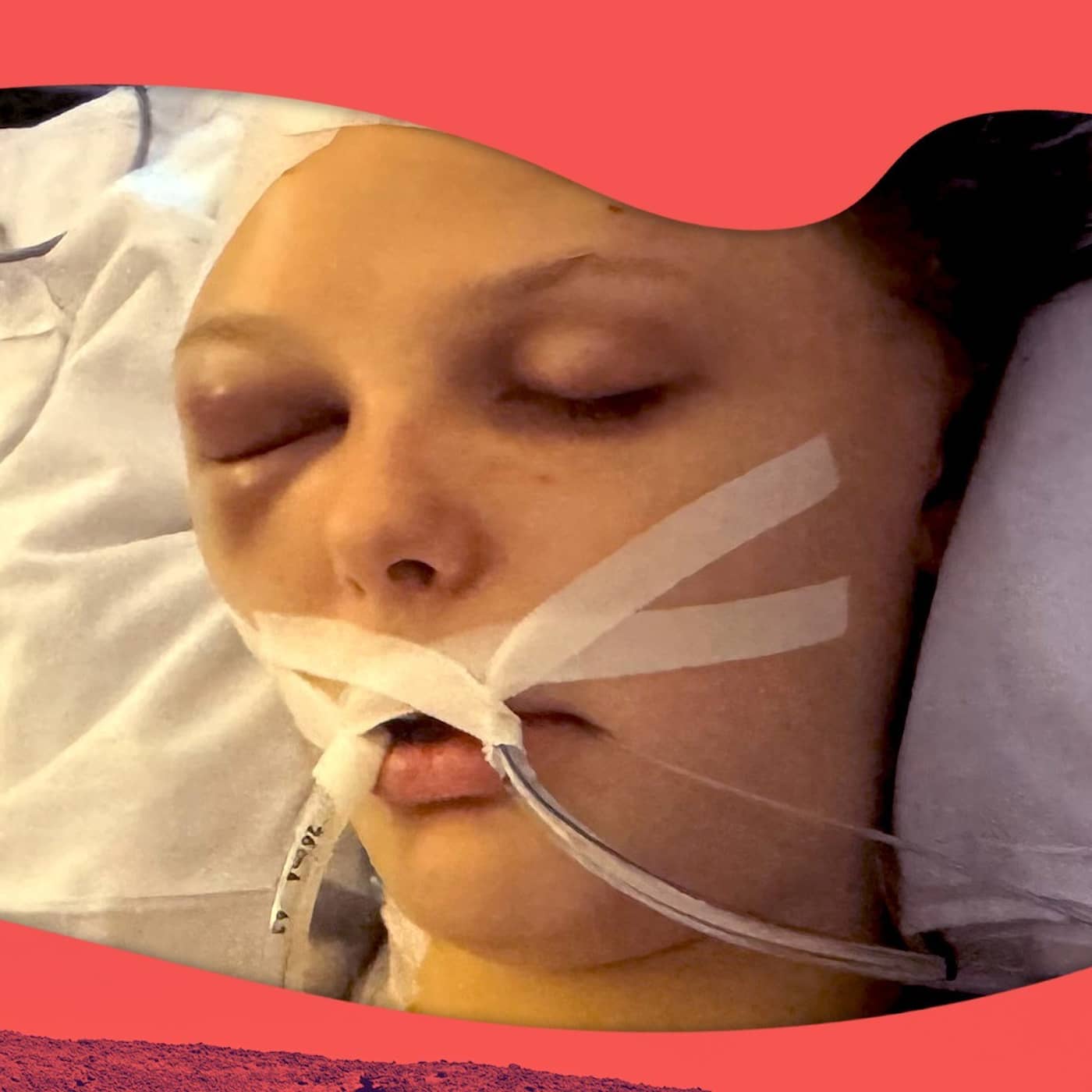 Tove, 17, fick hjärnblödning – vaknade efter 17 dagar artwork