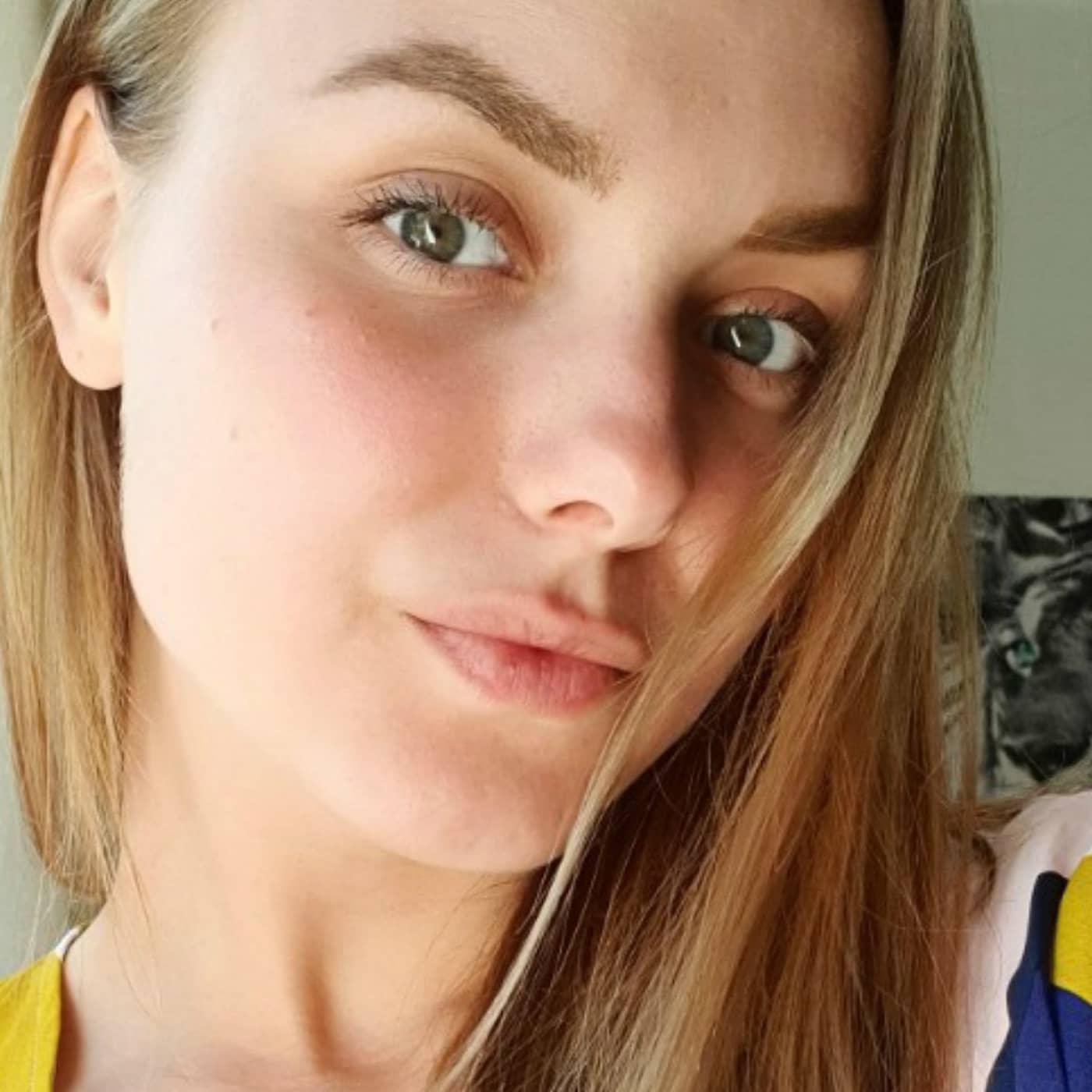 Helvetet efter hundattacken: "Trodde hon skulle dö" artwork