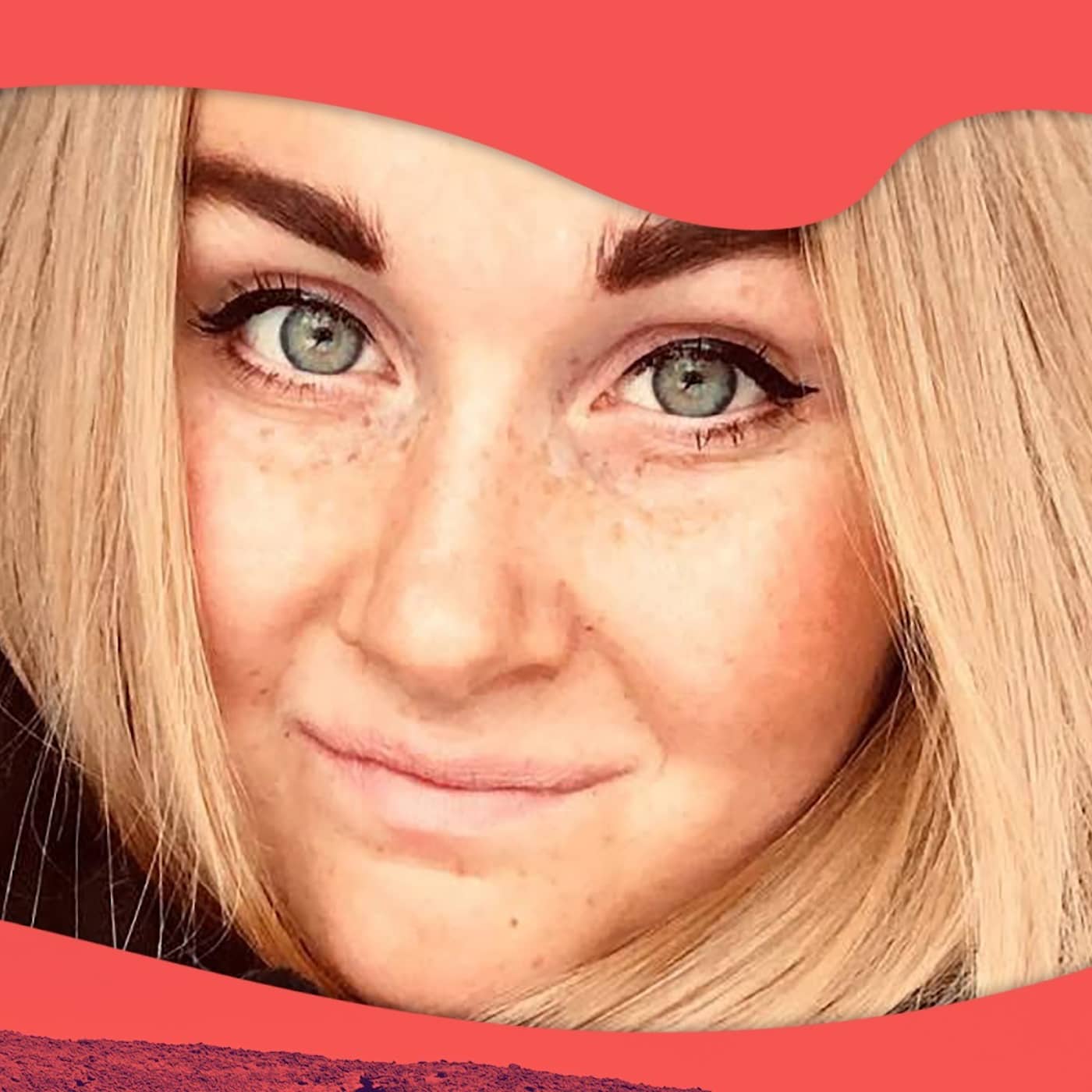 Hanna bröt käken på tre ställen: ”Ta bort elsparkcyklarna!” artwork