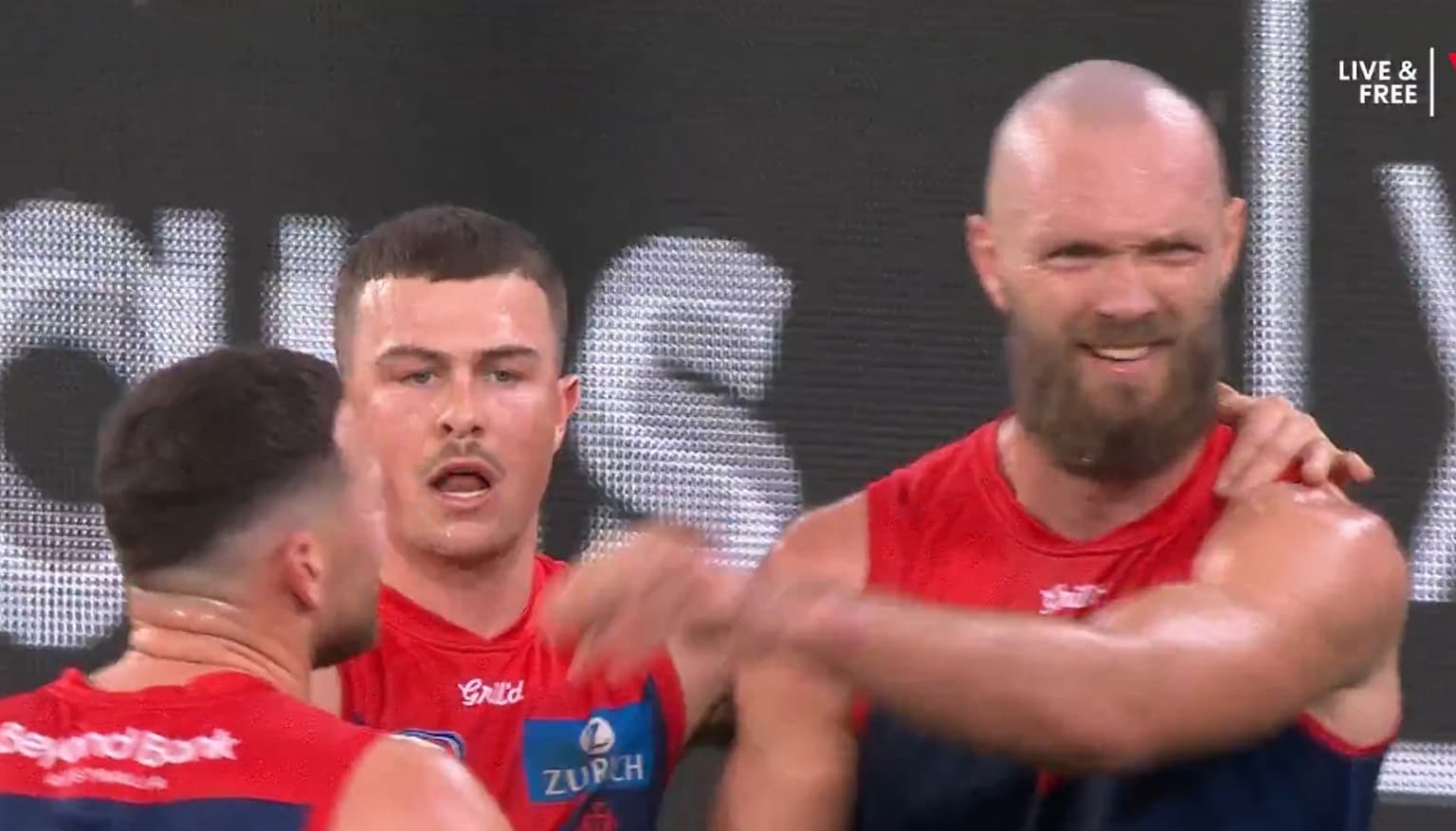 Demons left frustrated and does the AFL need to assess their concussion tests? artwork